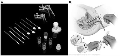 An emerging paradigms on cervical cancer screening methods and devices for clinical trails